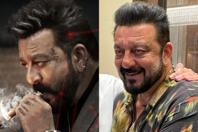 Sanjay Dutt: शूटिंग के दौरान घायल हुए संजय दत्त, लगा है टांका